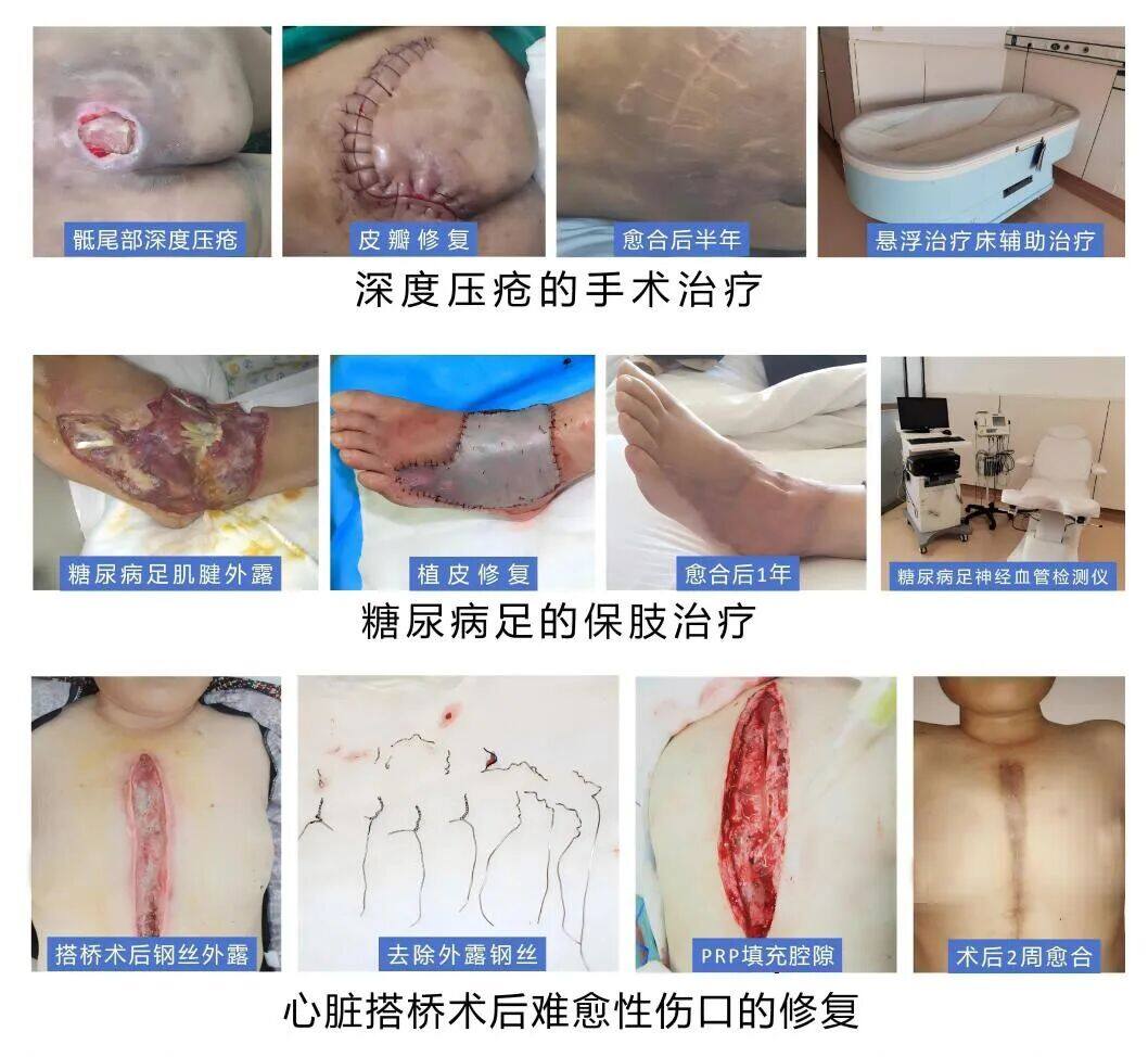 解放军总医院第四医学中心烧伤整形医学部：救生命于水火卫勤先锋谱忠诚；抚伤痕于无形大医精诚塑新生